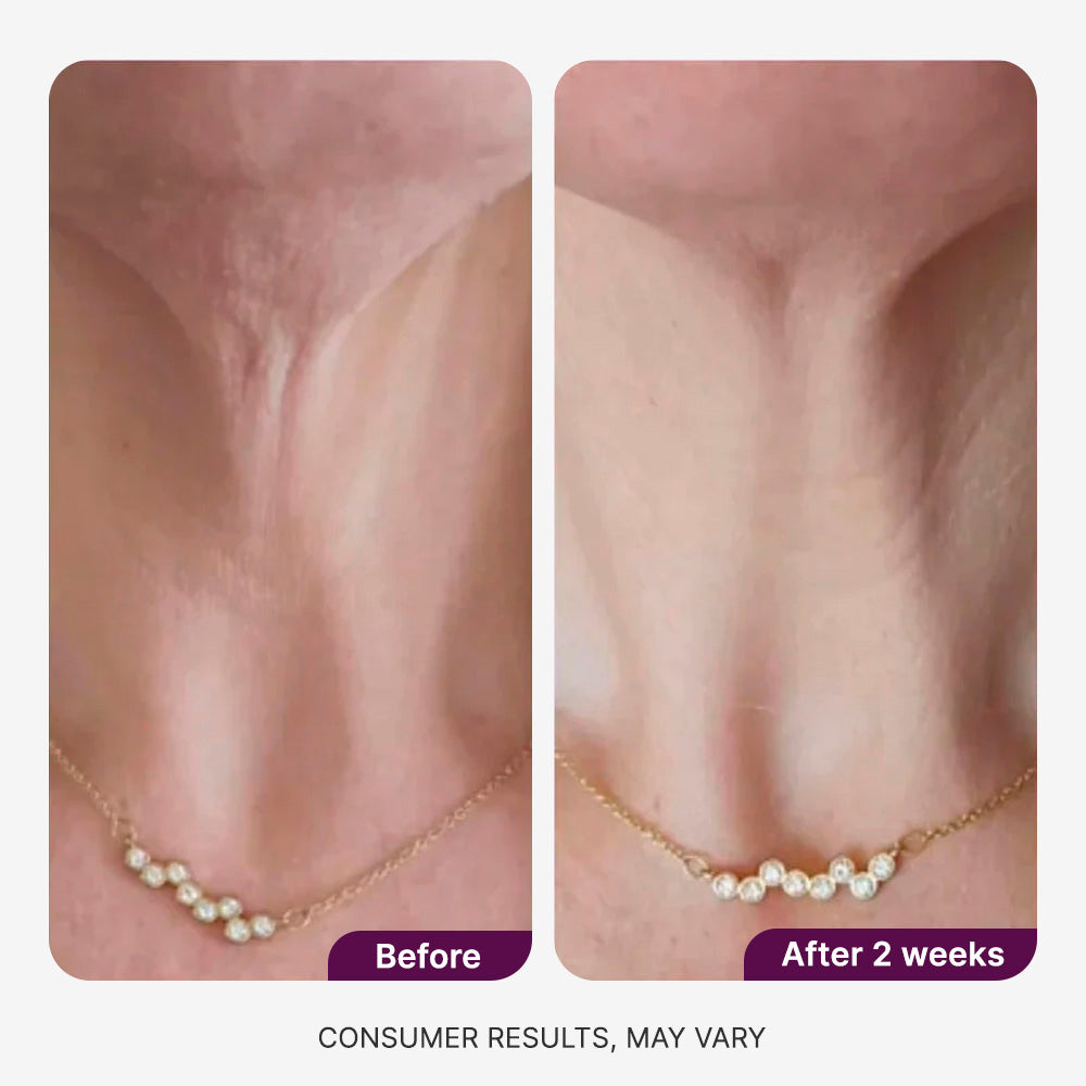 Neck Revival Cream